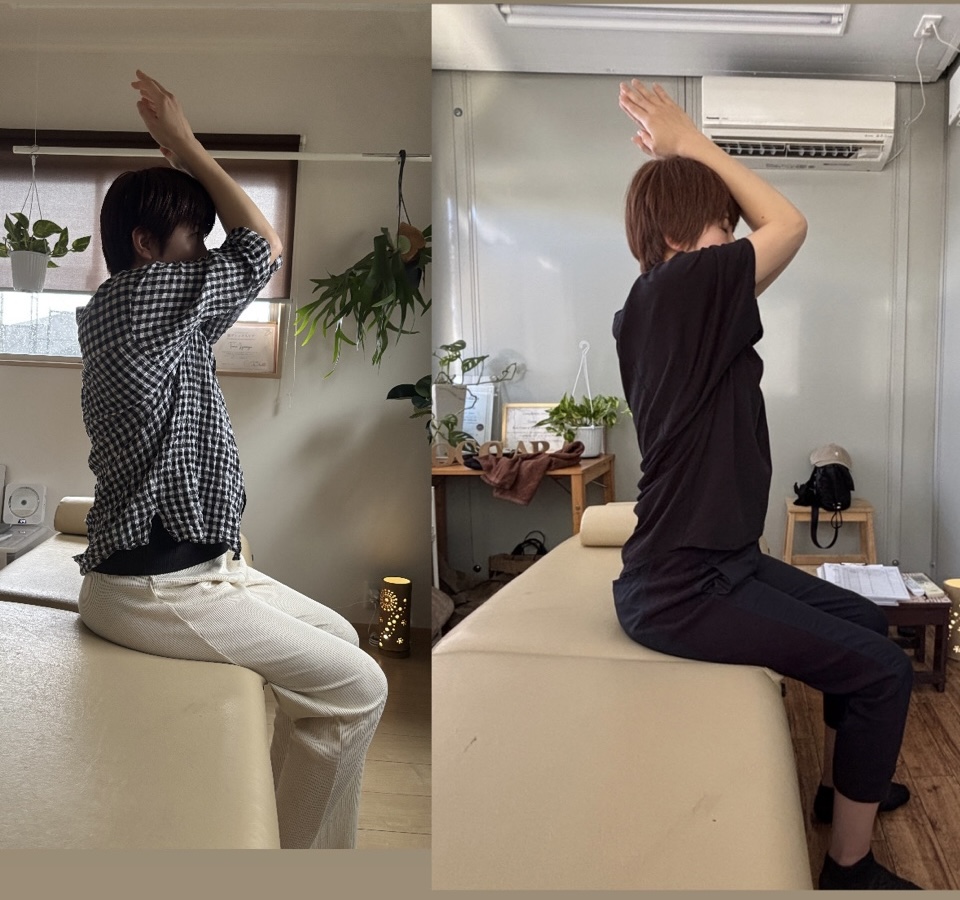 鳥栖整体サロンcococaraでの施術風景。ビフォーアフターの写真。2回目の施術で、胸椎・腰椎の可動性が上がりました。背中の痛みが随分楽になったそうです。